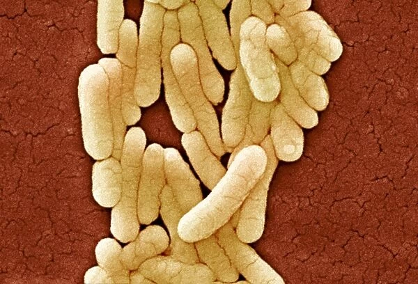 Salmonella typhimurium bacteria, SEM