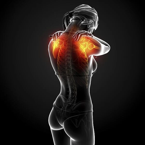 Shoulder pain, artwork F007  /  8340