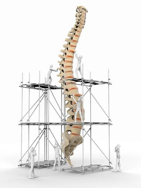 Spine with workers, spine repair F007  /  9884