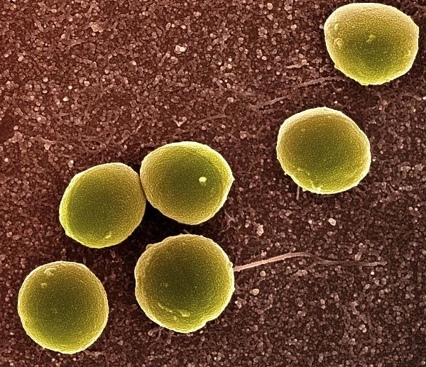 Staphylococcus aureus bacteria, SEM C013  /  4771