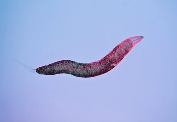 Threadworm, light micrograph