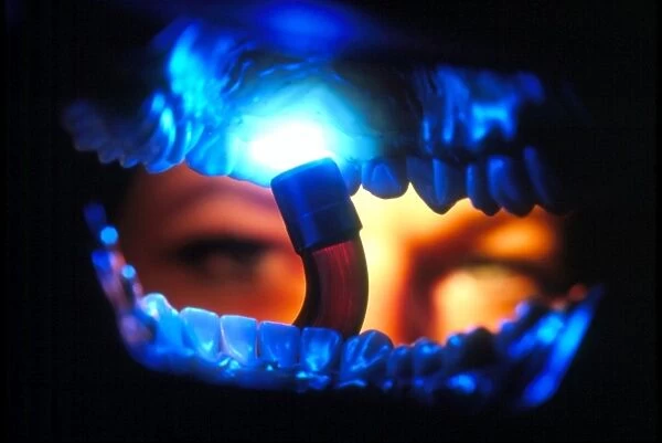 View from inside the mouth of dental crown fitting