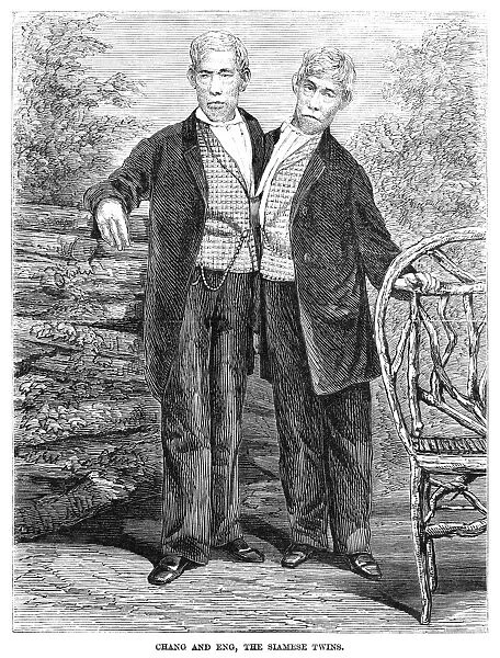 CHANG AND ENG (1811-1874). Thai-American conjoined twins and the origin of the