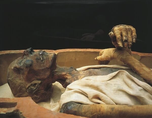 Mummy of Ramses II, detail