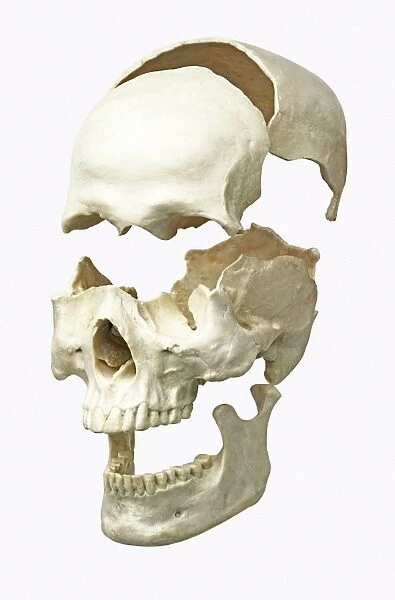 Separated parts of human skull