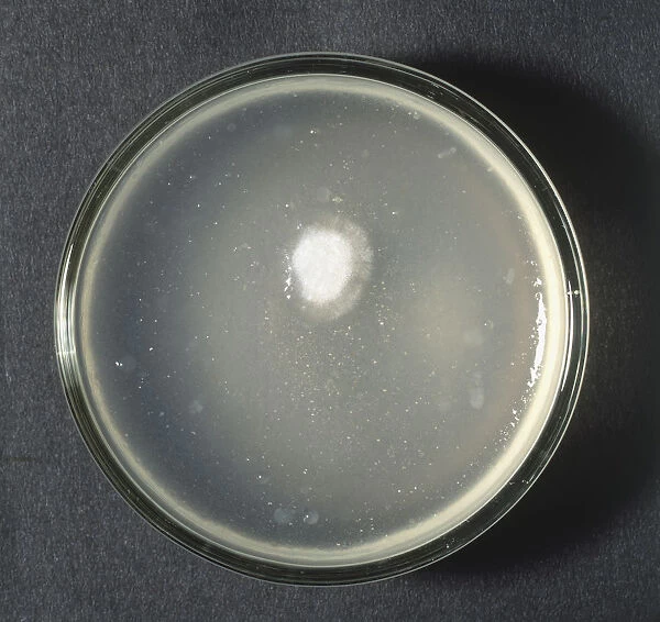 Yeast culture in petri dish, view from above