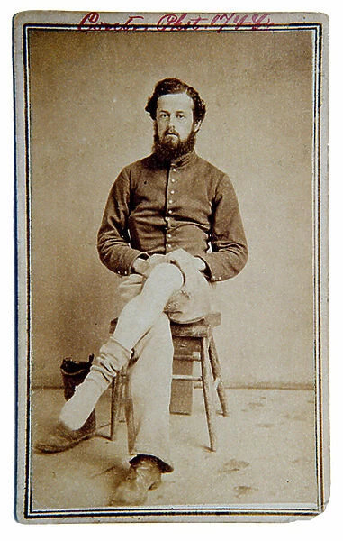 American Civil War, Union soldier displaying wounded leg