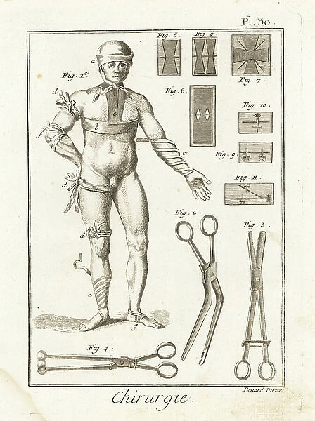 Bandages, corbin beak pliers, cane spout pliers, balls removal pliers and various sutures - Plate taken from ' L'Encyclopedie' by Denis Diderot (1713-1784) and Jean Le Rond D'Alembert (1717-1783), 1779 - Examples of 18th century bandages 1