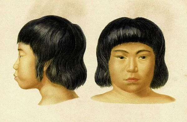 Breesian civilization: ' Breed Apinage, Province of Gaya Brazil'. Face of a man. In 'Dictionnaire universel d'Histoire naturelle' by Mr. Charles D'Orbigny, 1841-1849