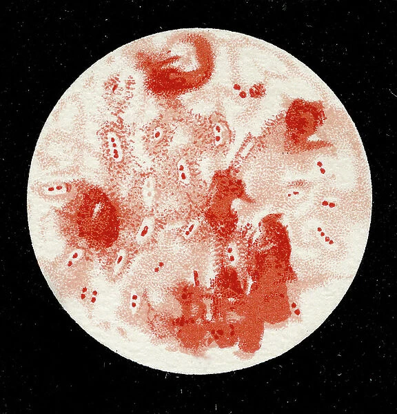 Colony of Streptococcus Pneumoniae, 1906 (litho)