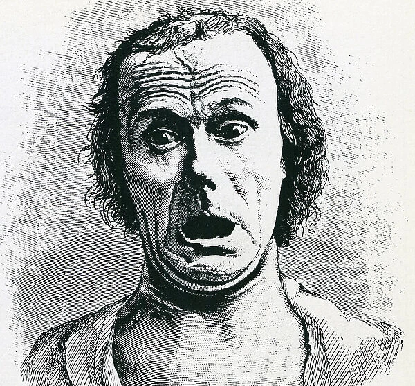 Expression of horror and anguish, 19th century (engraving)