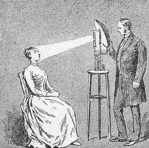 Hypnosis or hypnotic sleep caused by light. 19th century (engraving)