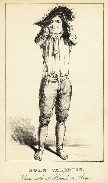 John Valerius, born without hands or arms, 18th century. 1869 (lithograph)