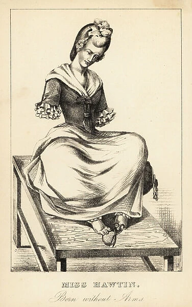 Miss Hawtin, born without arms, 18th century. 1869 (lithograph)