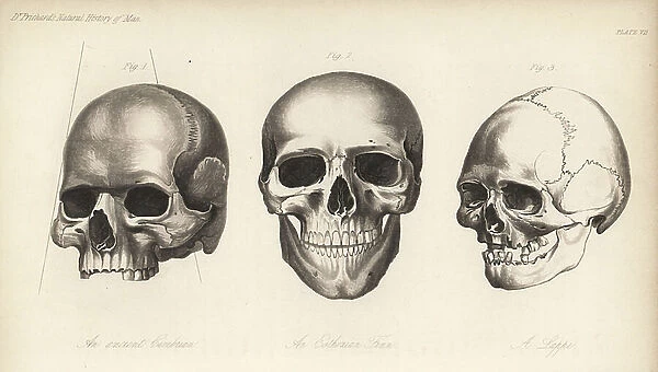 Skulls of an ancient Cimbrian, an Estonian Finn, and a Lapp. Lithograph by J. Bull from James Cowles Prichard's Natural History of Man (Balliere, London, 1855)
