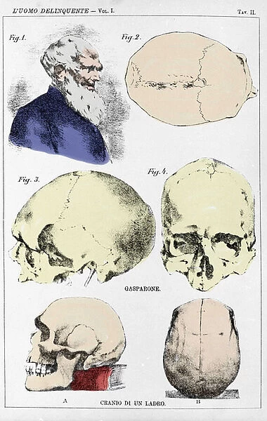 Study on the morphology of a delinquant skull by the Italian criminologist
