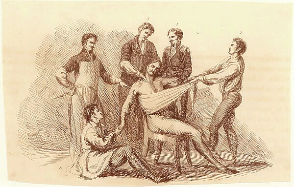 Surgeon and his assistants, before the introduction of anaesthetics, prepared to perform an amputation at the shoulder. Surgeon stands, left, next the assistant surgeon (behind patient)