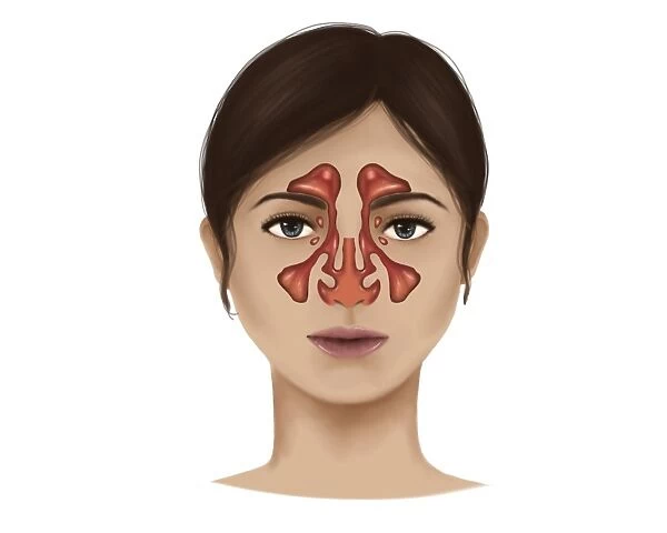 Anatomy of nasal sinuses