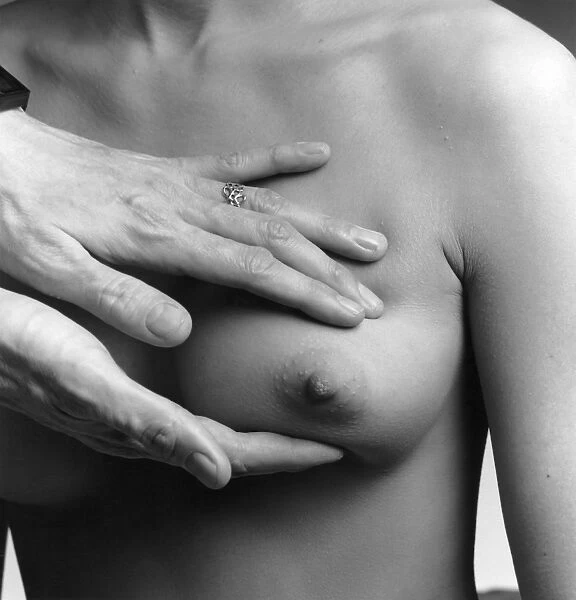 A female nude from the waist up with a doctors hands conducting a clinical breast