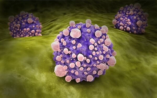 Microscipic view of pancreatic cancer cells