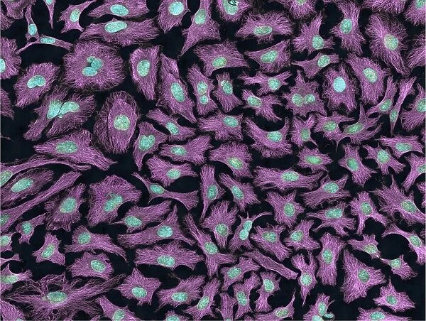 Multiphoton fluorescence image of HeLa cells