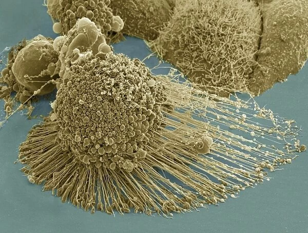 Scanning electron micrograph of an apoptotic HeLa cell