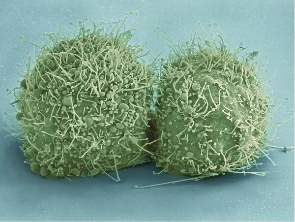 Scanning electron micrograph of just-divided HeLa cells