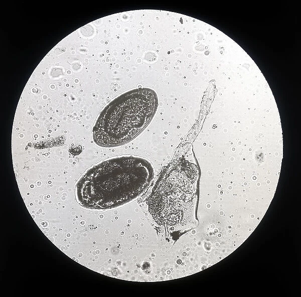 Eggs of the Lanceolate liver fluke (Trematodea) enlarged under a microscope