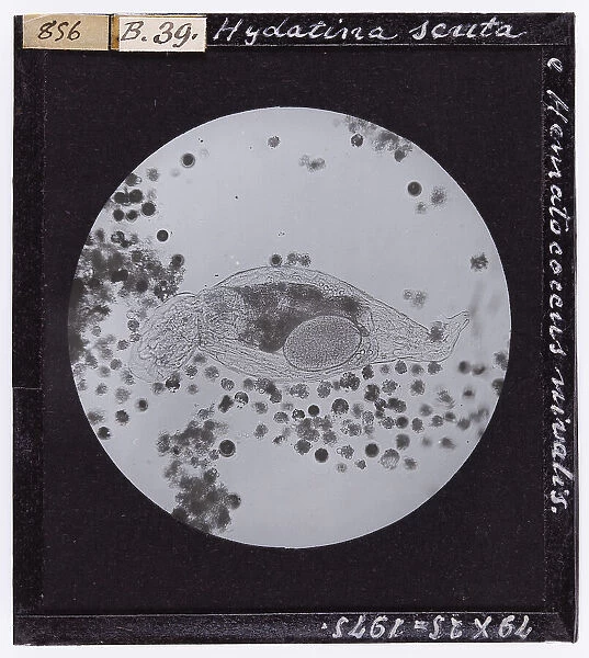 Hydatina scrita and Hematacoccus nivalis micro-organisms, enlarged under a microscope