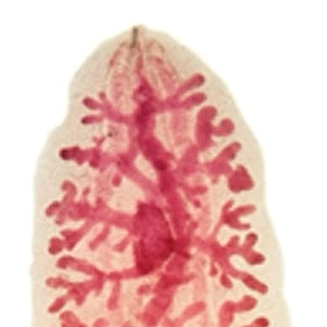 Clonorchis sinensis, liver fluke