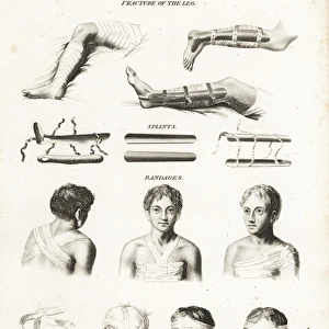 Surgical procedures from the 19th century