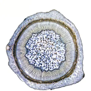 Blackcurrant plant stem, light micrograph