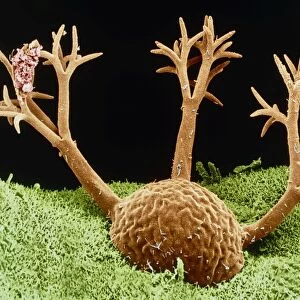 Dendrocometes protozoan