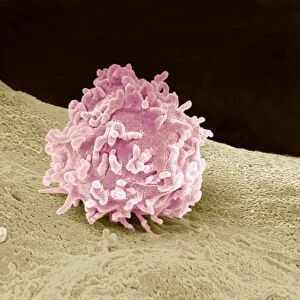 Granulocyte, SEM