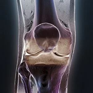Healthy knee, CT scan C018 / 0414