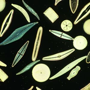 Light micrograph of assorted diatoms