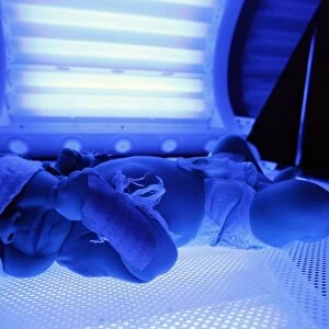 Light therapy for neonatal jaundice C015 / 6816