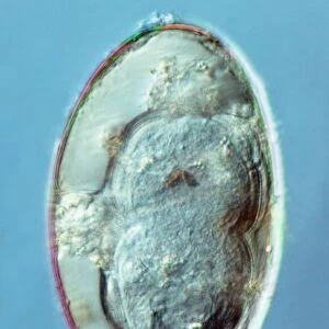 Liver fluke egg, macro photograph
