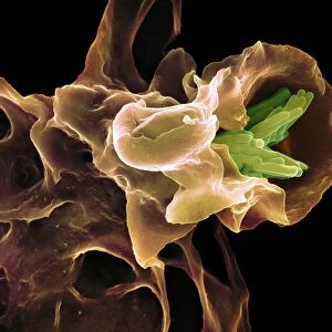 Macrophage engulfing TB bacteria, SEM