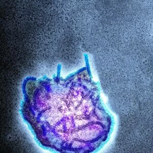 Measles virus particle, TEM C015 / 7160