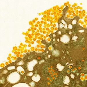 MERS coronavirus, TEM C015 / 7155