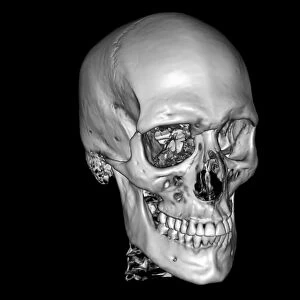 Normal skull, 3D CT scan C016 / 6328
