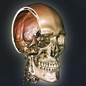 Normal skull, 3D CT scan C016 / 6330