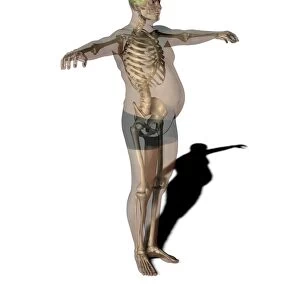 Obese man, anatomical artwork
