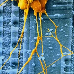 SEM of human nerve cells
