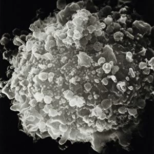 SEM of whole T-cell infected with HIV