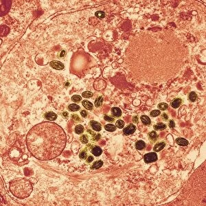 Smallpox virus particles, TEM C016 / 9447