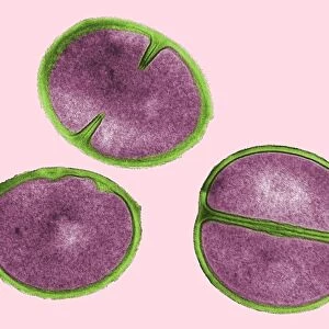 Staphylococcus aureus dividing, TEM