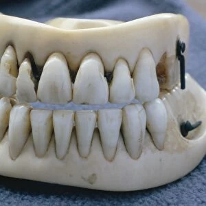 Waterloo false teeth