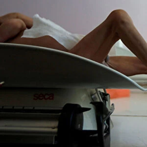 A boy lies on a weighing scale at a malnutrition treatment center in Sanaa